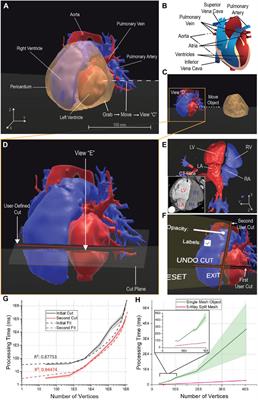 Virtual Reality for Interactive Medical Analysis